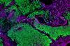 Brain organoid