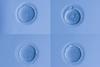 Four light micrographs of human egg cells