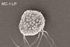 Bacteria seek out cancer and kill it nature nanotech