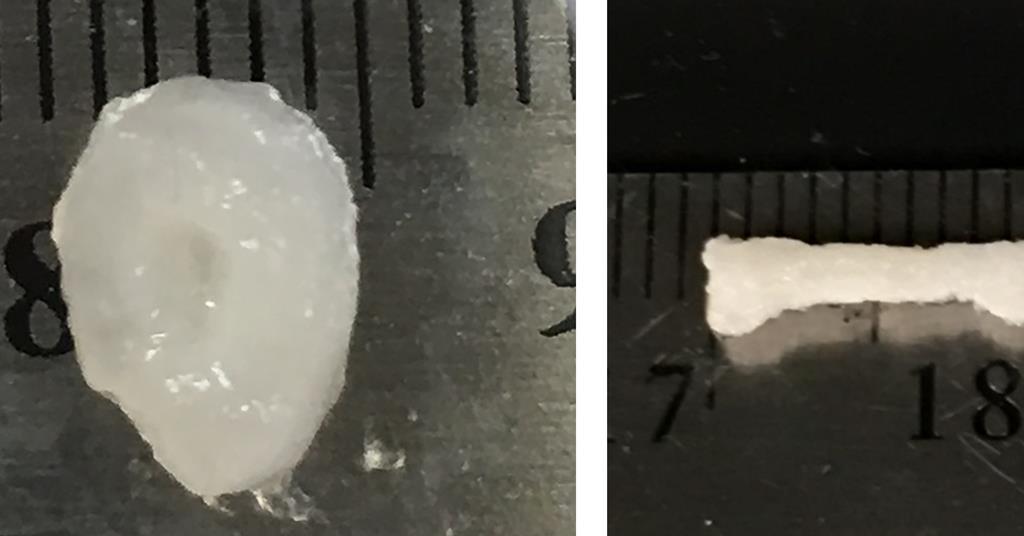 Microgel supports 3D printing technique that builds organs out of stem ...