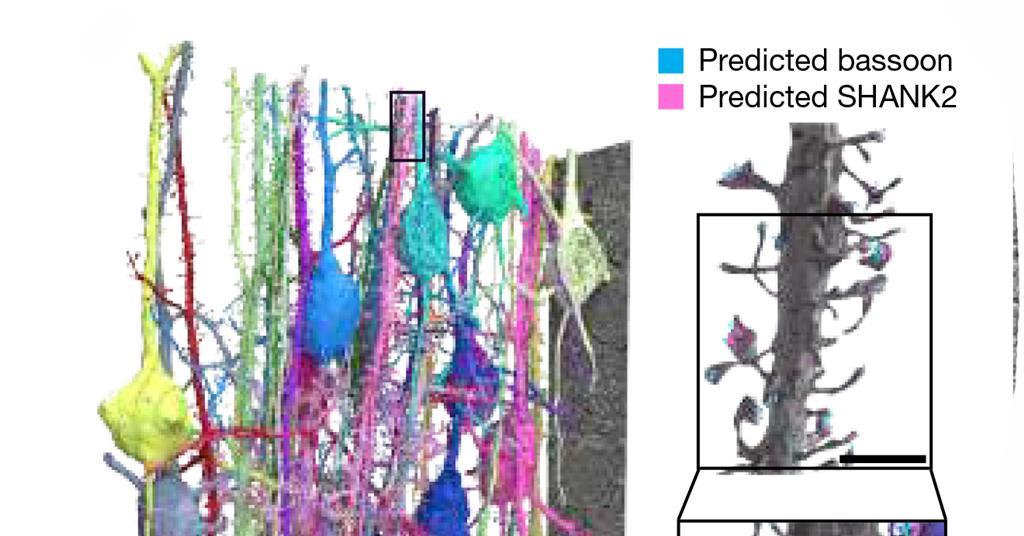 Blown up brain cells’ connections and chemistry traced at incredible ...
