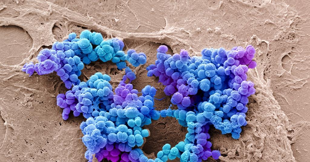 Molecular machine drills holes in antibiotic-resistant bacteria killing them