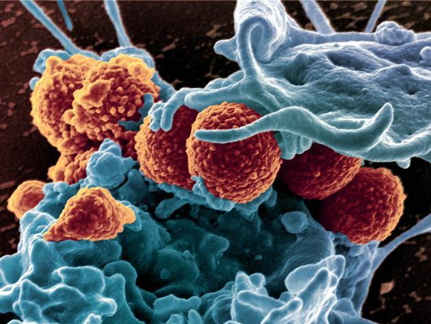 Review plots path to face down antimicrobial resistance deaths | News ...