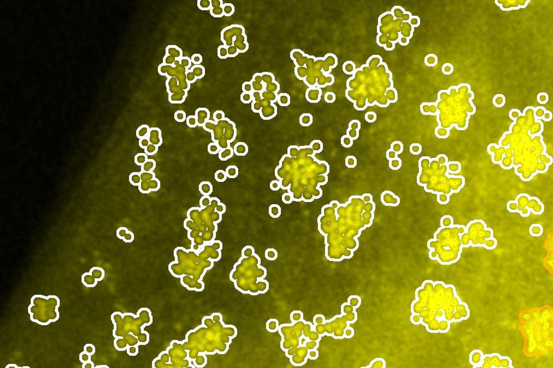 Unveiling the Evolution of Ruthenium Catalysts for Ammonia Decomposition