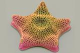 A star-shaped diatom with a textured surface