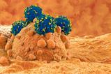 Cancer cell represented in orange on a dark orange background, covered by blue spheres with yellow segments representing CAR-T cells