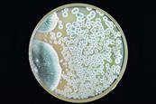Colonies of Penicillium mold growing on agar plate
