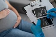 Pregnant woman in the background sitting on a couch while a doctor looks at an ultrasound image of a fetus on a clipboard in the foreground.