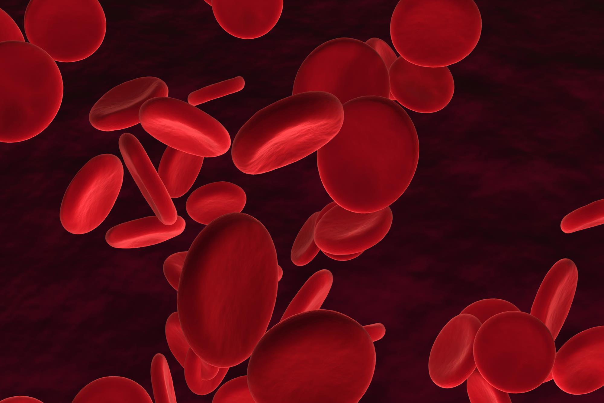 Причины б12 дефицитной анемии. Апластическая анемия эритроциты форма. Витамин в12 эритроциты. В12 дефицитная анемия клетки крови. В12-пернициозная анемия.