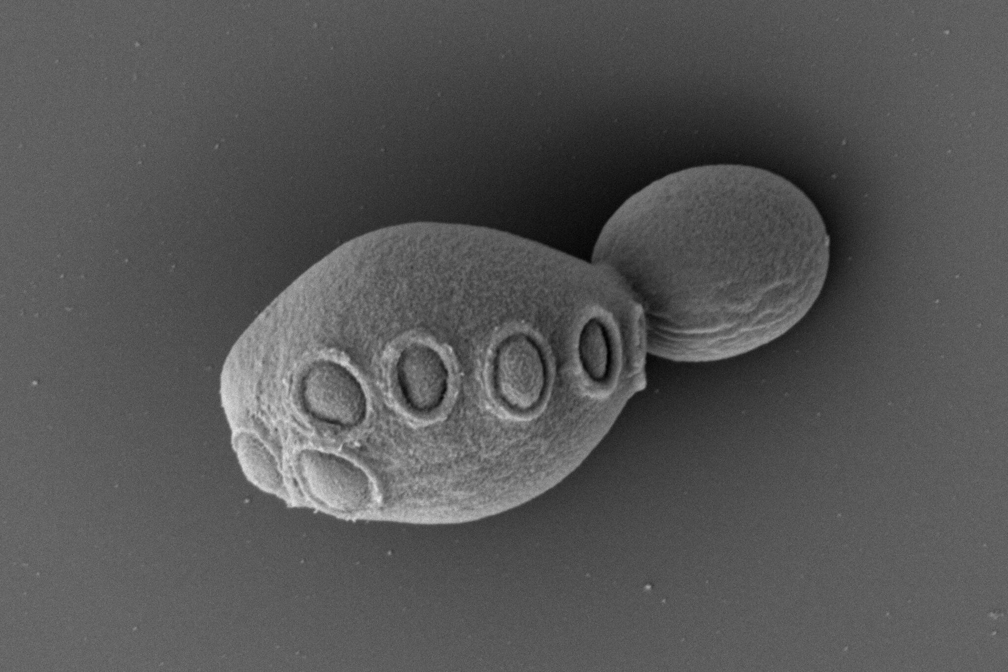 Synthetic yeast genome project creates strain with over 50