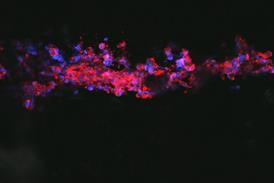 A micrograph of red and purple organic shapes on a black background