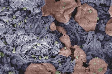 Nanoparticles (green) help form blood clots in injured liver