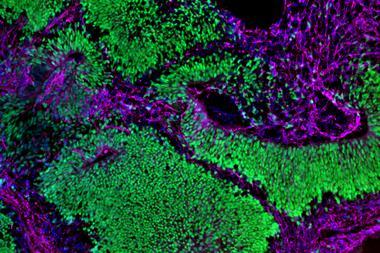 Brain organoid