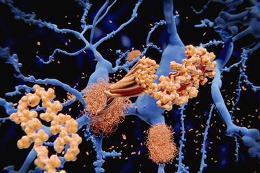 Illustration of amyloid-beta peptide accumulating on amyloid fibrils which build up as dense amyloid plaques, as seen in Alzheimer's disease