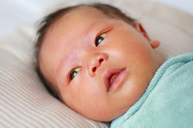 Infant with Neonatal hyperbilirubinemia. Jaundice.