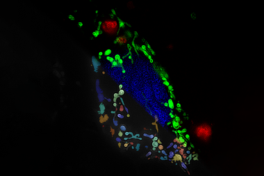 An image showing super-resolution imaging of breast cancer cells