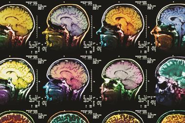Coloured sagittal mri scans of the human brain - Hero (p3320329)