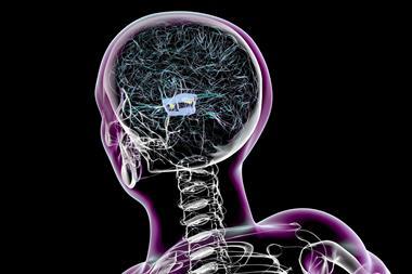 A human brain with Parkinson's disease showing a structure a it's centre
