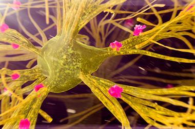 A digital artwork of a nerve cell with amyloid plaques