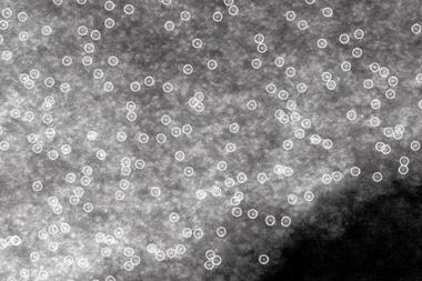 A blotchy grey mass with a large number of small white circles around lighter areas.
