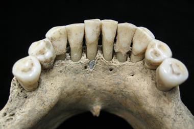 A picture of a 12th century nun's teeth