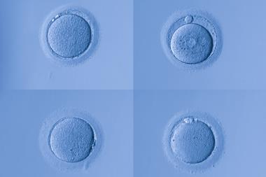 Four light micrographs of human egg cells