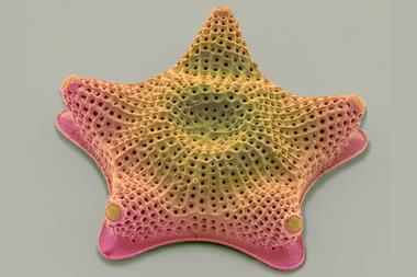 A star-shaped diatom with a textured surface