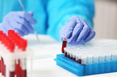 Scientist working with blood sample in a laboratory