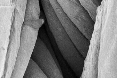 A black and white SEM image showing fibres of ligament