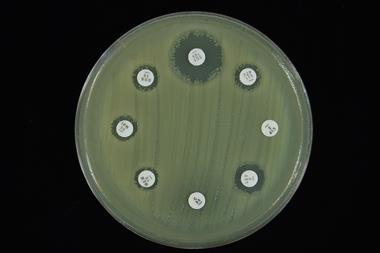 A picture showing an antimicrobial susceptibility test