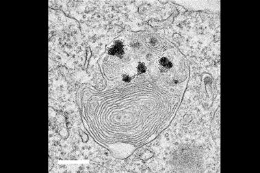 An image showing NPs in cancer lysosomes