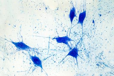 An image showing a light micrograph of human brain tissue showing neurons and glial cells
