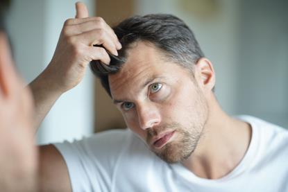 A man checking his hair line