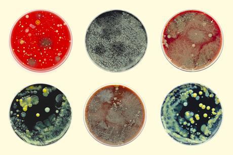 Bacteria cultures