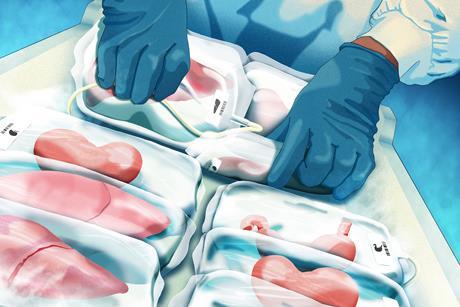 A drawing of gloved hands sorting through a hospital freezer shelf containing frozen organs