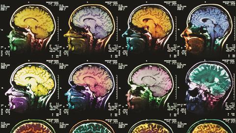 Coloured sagittal mri scans of the human brain - Hero (p3320329)