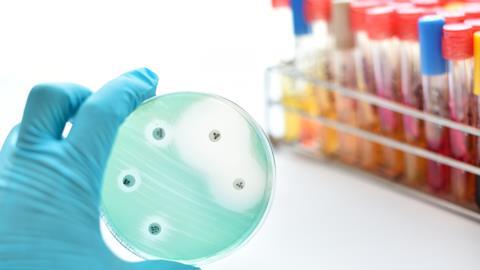 Antimicrobial susceptibility testing in petri dish 