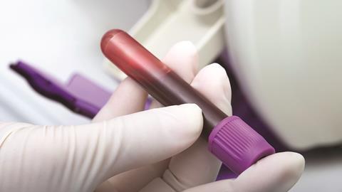 Blood samples in clinical environment 