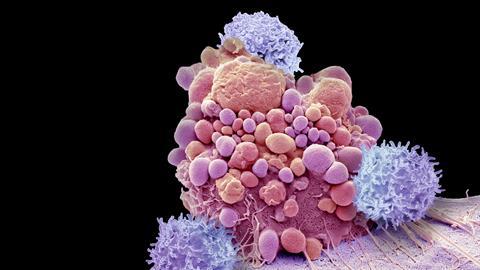 T-cells and brain cancer cell