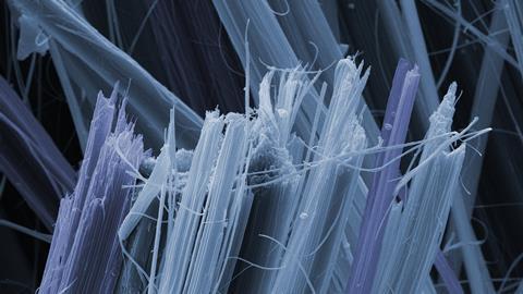 SEM of asbestos fibres