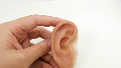 Prosthetic ear