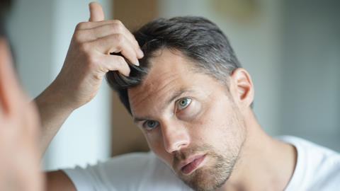 A man checking his hair line