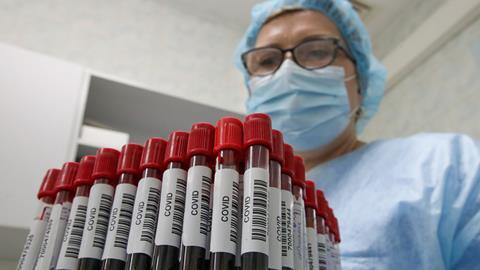 An image showing covid blood samples