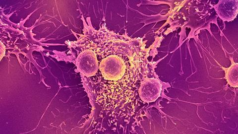 An SEM image of Cancer cell and T lymphocytes