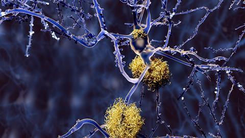 An image showing yellow 'bird's nest' tangles clustered along long blue thread-like structures