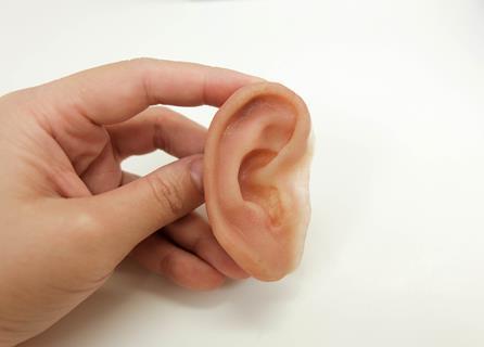 Prosthetic ear