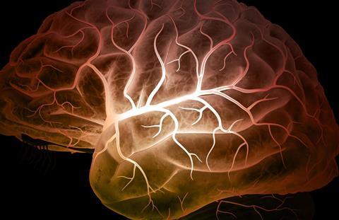 Middle cerebral artery in brain - Main