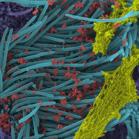 Ultrastructural analysis of SARS-CoV-2 interactions with the host