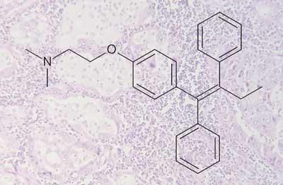 cancer-tamoxifen-400