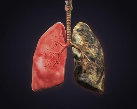 Healthy lung verses smoking lungs illustration